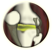 Illustration and knee joint with cartilage
