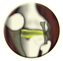 two bones in a joint, with cartilage and ligaments